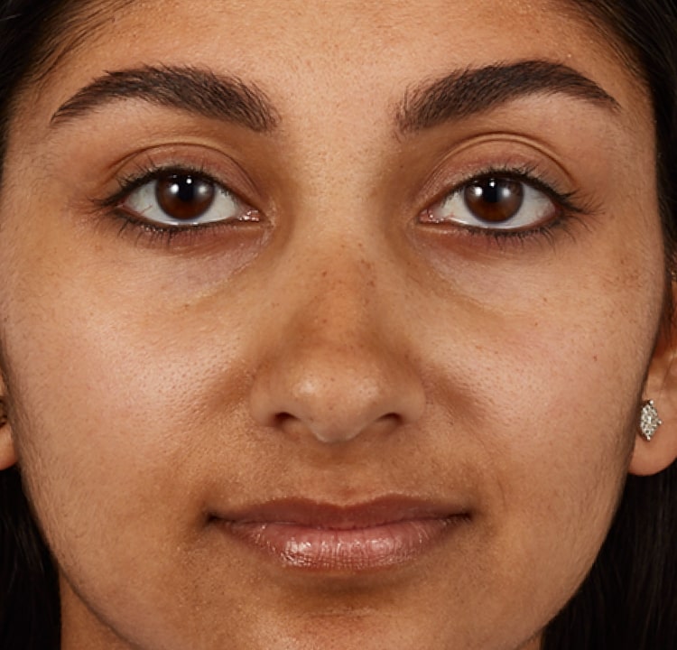 complexion before